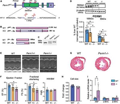 PERM1 regulates energy metabolism in the heart via ERRα/PGC−1α axis